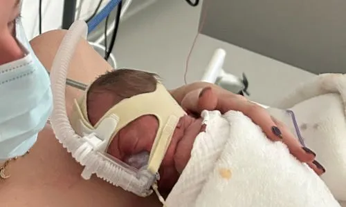 Une maman à l’hôpital fait du peau à peau avec son bébé né prématurément.